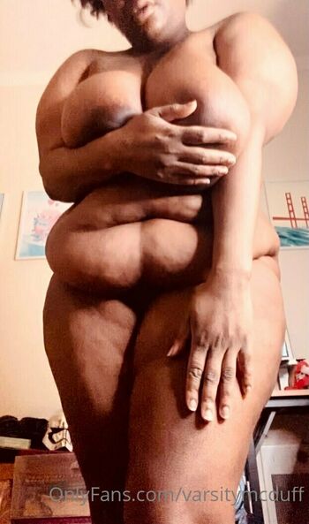 cherrycolaareola