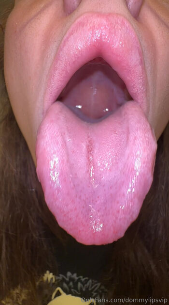dommylipsvip