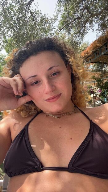 frecklebum
