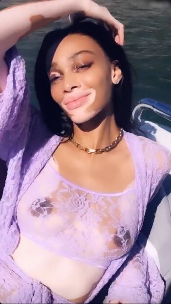 Winnie Harlow