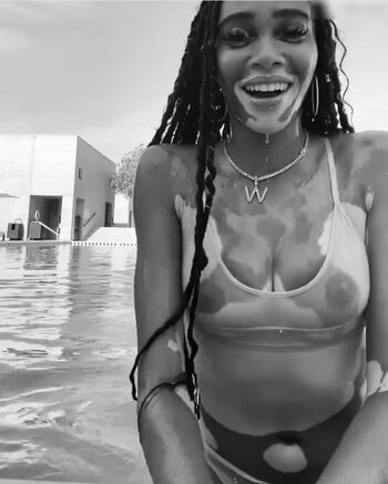 Winnie Harlow