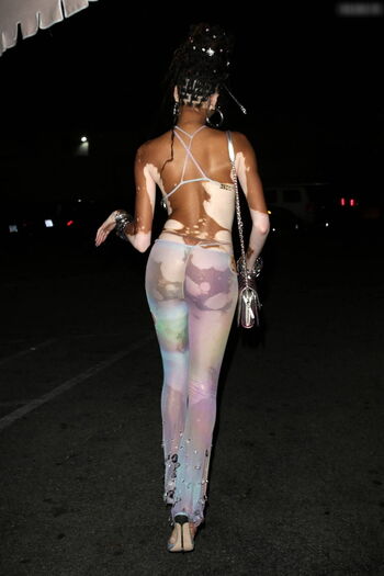 Winnie Harlow