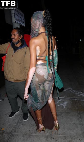 Winnie Harlow