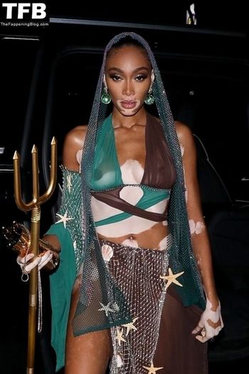 Winnie Harlow