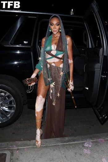 Winnie Harlow