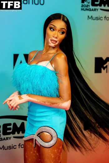 Winnie Harlow
