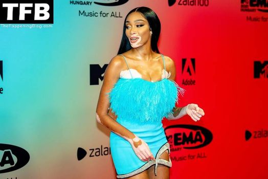Winnie Harlow