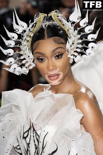 Winnie Harlow