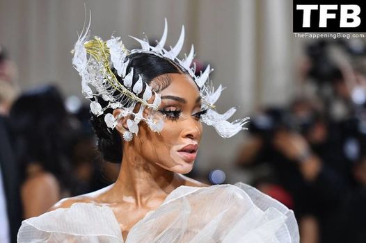 Winnie Harlow