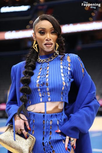 Winnie Harlow