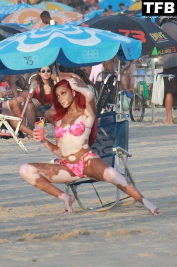 Winnie Harlow