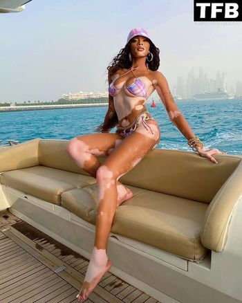 Winnie Harlow
