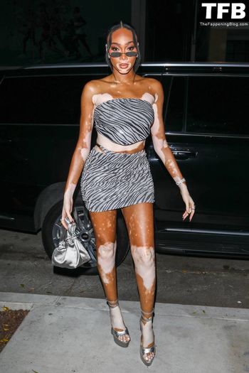 Winnie Harlow